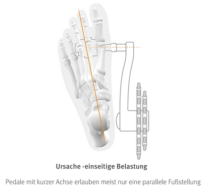 SQlab 521 City Pedale – ergonomische Flatpedale mit variabler Achslänge